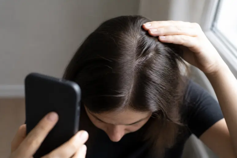 Suivi photographique de la densité capillaire sous lumière naturelle pour observer la pousse des cheveux